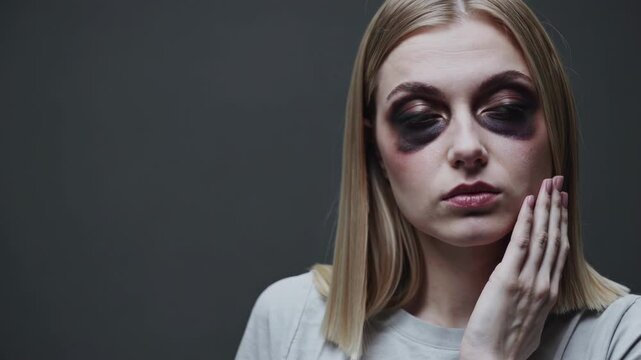 Fatigued woman showing sleep deprivation
