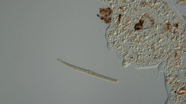 das wimpertier sumpfwurm (spirostomum) und eine am&ouml;be unter dem mikroskop im Wassertropfen