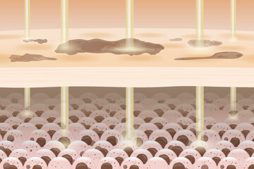 Laser passed the skin layer to reduce and remove dark spots on facial and treat scars. Illustration about dermatology technology for beauty. Pico,  Co2 Fractional Laser.