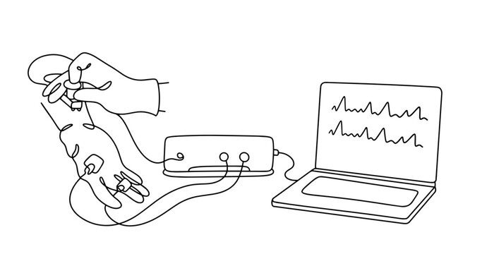 Electromyography