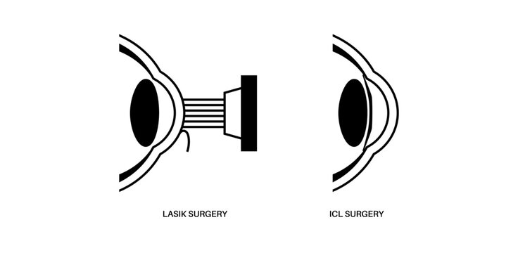 LASIK and ICL EVO