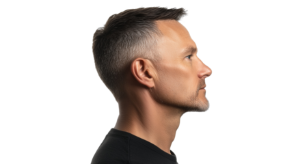 PNG, Hair loss concept, man with alopecia, isolated on white background, generated by Generative AI technology.