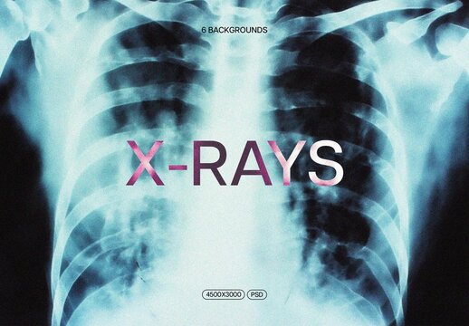 X-Ray Backgrounds With Generative AI