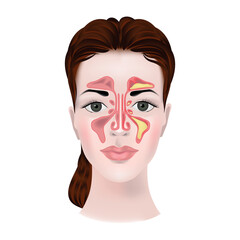 Sinusitis. Image of the maxillary sinuses on a woman's face with a medical diagram. Vector illustration