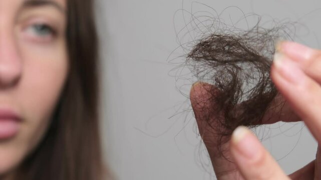 Woman hair loss. Hand holding drop down hair. Lots of fallen hair. Hair loss problem, hormonal failure, stress, diet, scalp and hair bulb disease.
