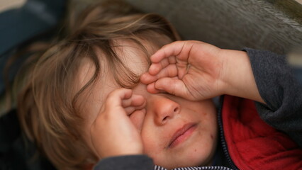 Fototapeta premium Upset tired baby toddler rubbing face with hand, tearful sad exhausted child