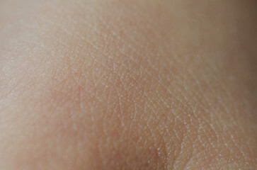 Skin close-up