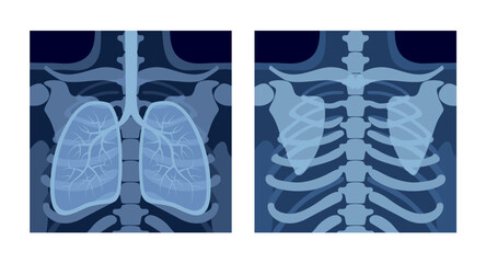 Cartoon-style X-rays of human lungs and chest. Vector illustration in cartoon flat style
