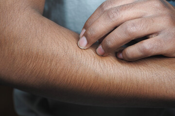 man suffering from itching skin, close up.