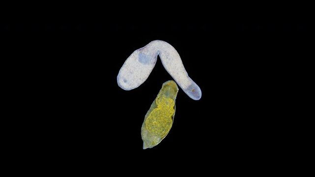 Worms Dinophilus taeniatus and Monocelis sp. under microscope, Polychaeta and Platyhelminthes. Samples found in the White Sea.