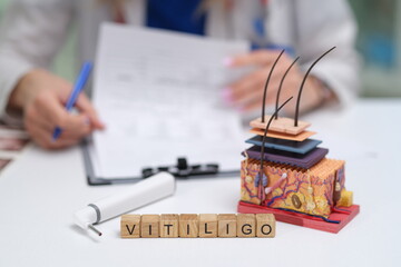 A detailed skin model showcasing the distinct effects of vitiligo and emphasizing its unique...