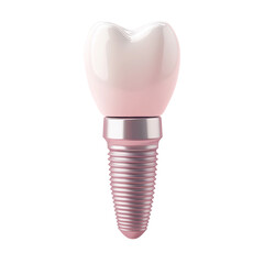 A 3D rendering of a dental implant showcasing a white crown atop a silver screw implant against a pink backdrop.