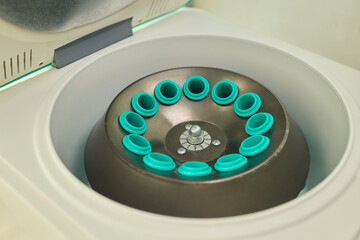 Centrifuge Rotor with Sample Tubes Utilized in a Comprehensive Laboratory Setup and Analysis