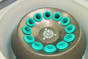 Centrifuge Rotor with Sample Tubes Utilized in a Comprehensive Laboratory Setup and Analysis
