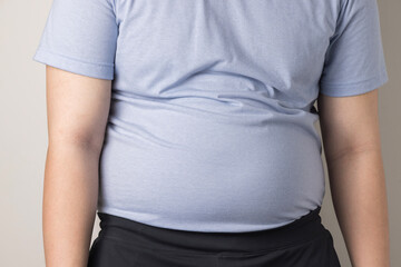 overweight or obese man shows fat deposits in the abdomen. healthcare, medicine concept. he is dieting and losing weight.