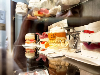 Dental casts displayed in a hospital dental office during a clinical evaluation