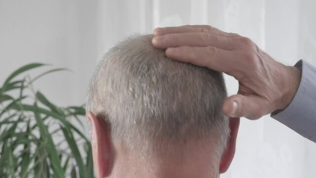 Rear view older man with bald patches on scalp, showing signs alopecia and age-related hair thinning, Anti-aging treatments for balding men, hair loss
