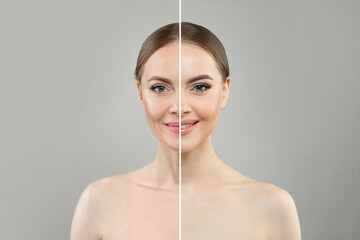 Pretty woman before and after posing on white background. Two women portrait. Rejuvenation,...