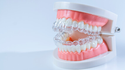 Invisible dental teeth brackets teeth aligners on blue background. Plastic braces dentistry retainers to straighten teeth on a white background