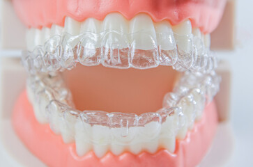 Close-up. Transparent aligners for artificial jaw teeth on a white background