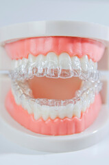 Close-up. Transparent aligners for artificial jaw teeth on a white background