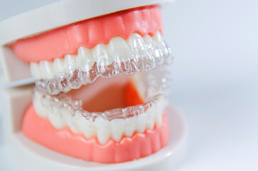 Invisible dental teeth brackets teeth aligners on blue background. Plastic braces dentistry retainers to straighten teeth on a white background