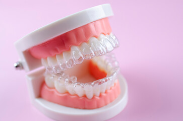 Invisible and removable aligners for teeth alignment on a pink background
