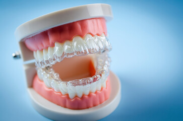 Close-up. Transparent aligners for artificial jaw teeth on a blue background