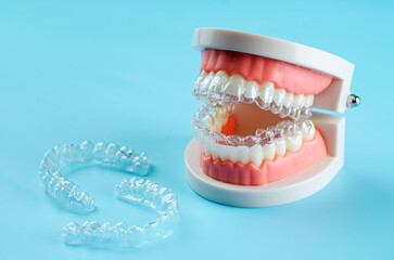 Close-up. Transparent aligners for artificial jaw teeth on a blue background