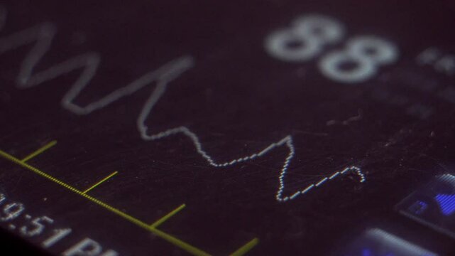 EKG monitor in hospital. Blood oxygen saturation, heart rate.
