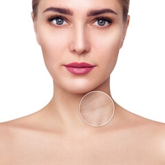 Zoom circle shows wrinkles on the neck.