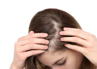 Fototapeta premium Girl with hair loss problem on white background, closeup