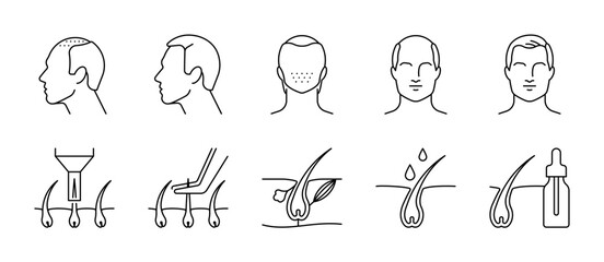 Hair grafts. Hair transplantation issue, icon set - bald man, bald head, baldness, follicle, extraction, implanter pen, growth, hair serum. Linear illustration, editable stroke icon