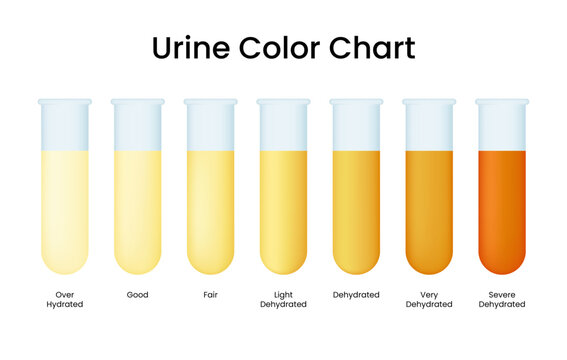 Urine Color Chart Images &ndash; Browse 357 Stock Photos, Vectors, and Video