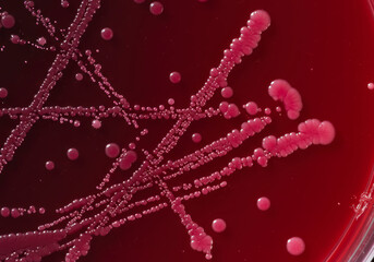Dark red and pink bacterial colonies forming on a red agar plate, showcasing microbial growth in a laboratory culture dish.