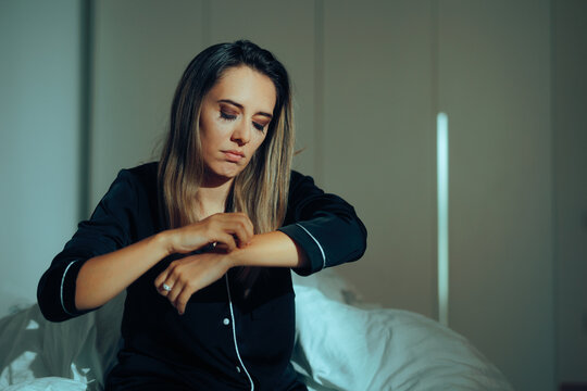 Woman feeling Itchy Having a Rash on her Arm. Unhappy lady suffering from insect bites in a hotel bedroom
