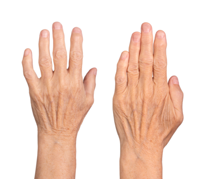 Closeup of elderly caucasian woman's hands, dorsal view with fingers spread, raised in a neat and expressive pose, wrinkled skin with visible veins and nails. Isolated on white background. - Powered by Adobe