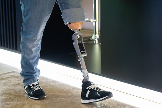 Modern prosthetic leg. Close-up of a man with a prosthetic leg.