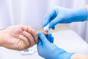 Close-up of medical worker taking patient's blood sample with finger prick kit. Medical concept....