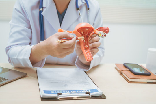 Male doctor treating female uterine diseases at hospital table, discussing uterine disease models,diagnosing uterine tumors, endometriosis,bacterial vaginitis,cervical cancer,HPV-related infections