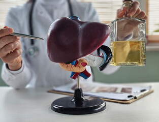 Alcoholic liver damage and liver cirrhosis concept with liver and alcohol. Cirrhosis by alcoholism hepatitis B or C