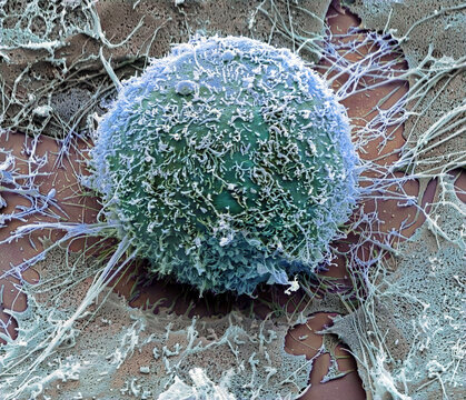 Hela cell, SEM