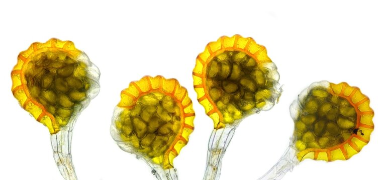 Microsorum sp. sporangia under microscope. Fern sporangium