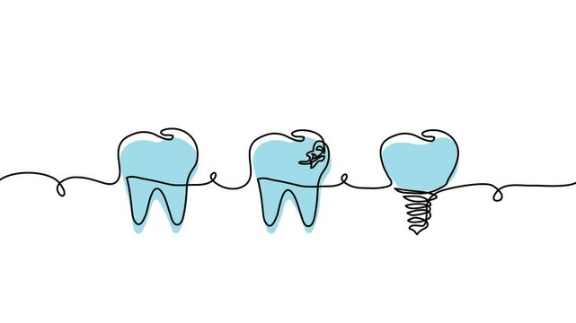 Health tooth, molar with caries and implant animated illustration. One continuous self drawing line animation, footage with teeth