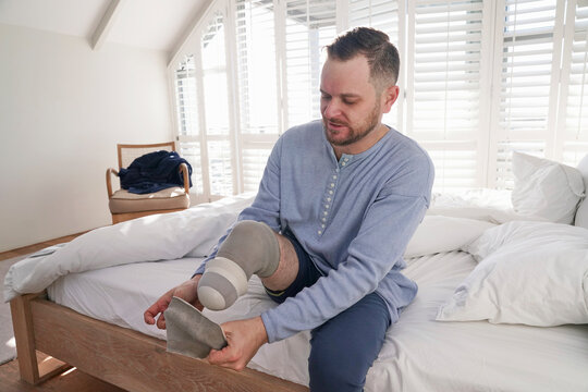 Man attaching leg prosthesis