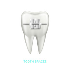 Tooth with metal brace, isolated realistic molar with bracket. Vector exodontist treatment and endodontist care health concept. Orthodontic dentistry and alignment of teeth. Healthy lifestyle