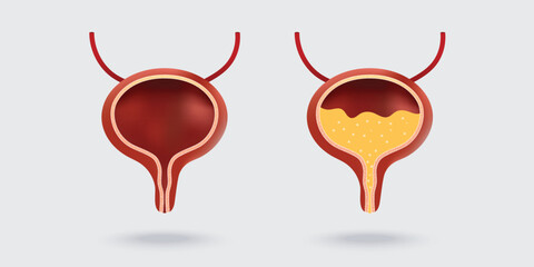 Human bladder anatomy. Empty and full urinary bladder. Vector illustration isolated on white background
