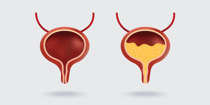Human bladder anatomy. Empty and full urinary bladder. Vector illustration isolated on white background