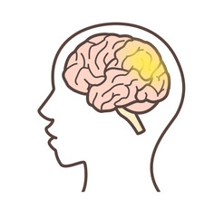 レビー小体型認知症を表現した脳のイラスト