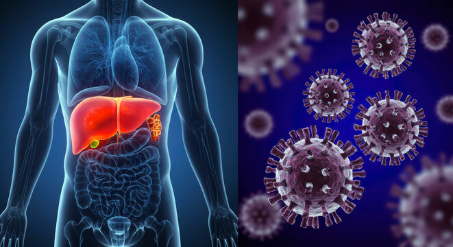 3D Illustration of Hepatitis B Infection: Liver with Highlighted Viral Cells Inside the Human Body